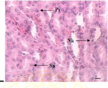 Gambar 4.4  Gambaran  mikroskopis  ginjal  mencit  yang  mengalami  kerusakan  pada sel tubuli ginjal mencit  pada perbesaran 600x dan skala bar  20 µm