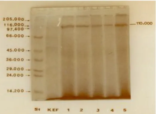 Gambar  3.  Fraksi  protein  EF  Streptococcus isolat Bali hasil  SDS-PAGE.  St  =  Protein    Standar;  KEF 