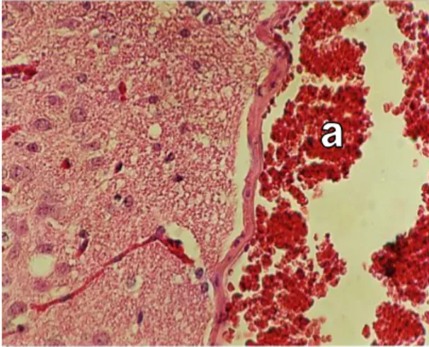 Gambar 4. Otak Mencit yang diinokulasi  dengan Isolat Streptokokus beta  hemolitik asal monyet  Pada  gambar terlihat adanya kongesti   disertai infiltrasi neutrofil pada  meninges (a)