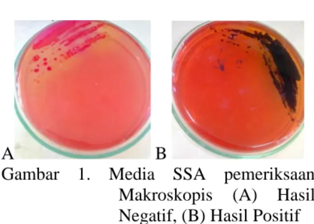 Gambar  1.  Media  SSA  pemeriksaan  Makroskopis  (A)  Hasil  Negatif, (B) Hasil Positif 