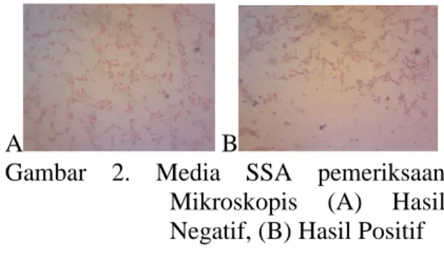 Gambar  2.  Media  SSA  pemeriksaan  Mikroskopis  (A)  Hasil  Negatif, (B) Hasil Positif 