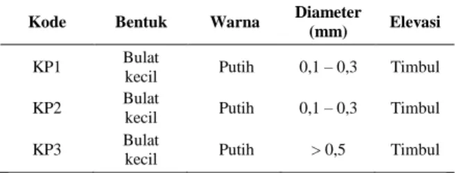 Tabel  1.  Hasil  Pengamatan  Morfologi  Koloni Bakteri Calon Probiotik 