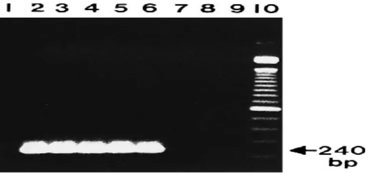 Gambar 3 Produk amplifikasi nested-2 Plasmodium sp dari sampel darah (Singh et al.1999)