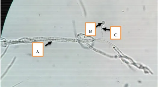 Gambar  5.  Morfologi  Mikroskopik  Jamur  Hasil  Purifikasi  Akar  Anggrek  Spathoglottis  sp