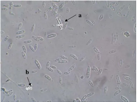 Gambar 1. Hasil Pengamatan mikroskopis : (a) Makrokonidia dan (b) Mikrokonidia  Jamur  Fusarium sp