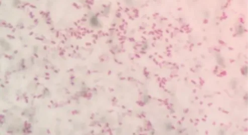 Gambar 2. Hasil biakan pada media Salmonella-Shigela Agar yang di tandaidengan tumbuhnya  koloni berwarna hitam