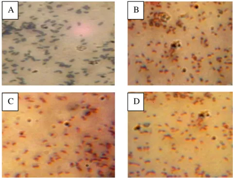 Gambar 2. Bentuk sel bakteri; a) Bacillus cereus, b) Shigella sp., c) Salmonella sp. dan d) Klebsiella sp
