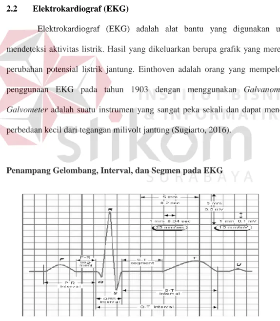 Gambar 2.2 Sinyal Jantung EKG Normal (Golrizkhatami, 2015) 