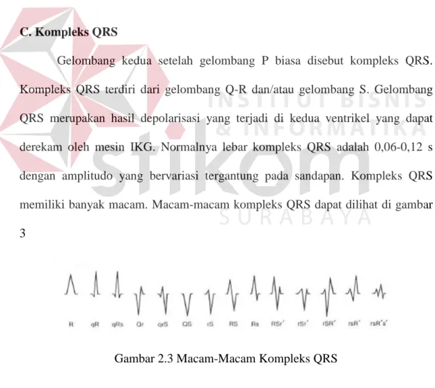 Gambar 2.3 Macam-Macam Kompleks QRS 