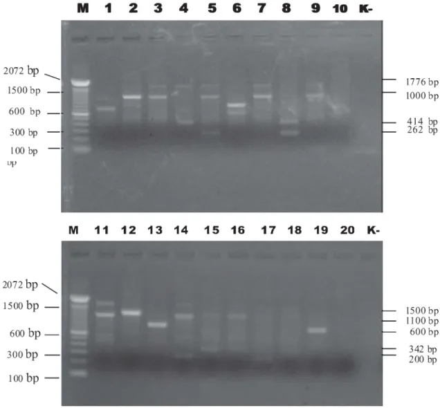 Gambar 1. Profil DNA genom isolat E. coli O157:H7 dengan metode RAPD pada agarose 1%.