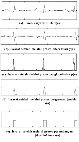 Diagram blok deteksi QRS yang digunakan dalam penelitian ini seperti terlihat pada Gambar 3.