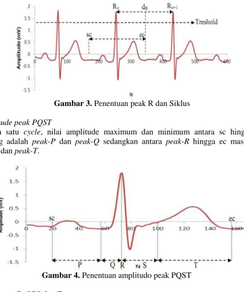 Gambar 4. Penentuan amplitudo peak PQST  Deteksigelombang P, QRS dan T 