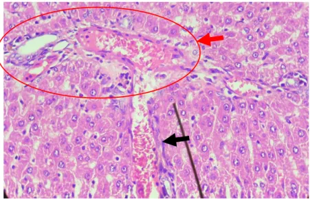 Gambar 5. Fibrosis ringan berupa munculnya sel-sel firbosit (tanda panah hitam)  di sekitar area porta (tanda panah merah)