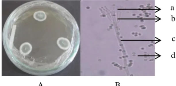 Gambar  8.  Aspergillus  sp.  UH  21  :  A.  koloni  pada  media  CYA  berdasarkan  karakter  makromorfologis,  B