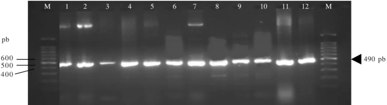Gambar 2. Hasil elektroforesis produk PCR amplifikasi DNA genom Xag menggunakan primer XAG-F dan XAG-R