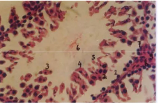 Gambar 4. A. Histologi kerusakan berat tubulus seminiferus kelompok II (200x)                    B