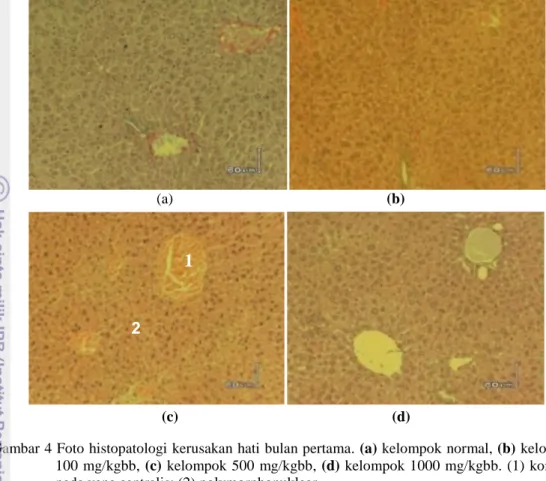 Gambar 4 Foto histopatologi kerusakan hati bulan pertama. (a) kelompok normal, (b) kelompok  100 mg/kgbb, (c)  kelompok 500  mg/kgbb, (d)  kelompok 1000 mg/kgbb