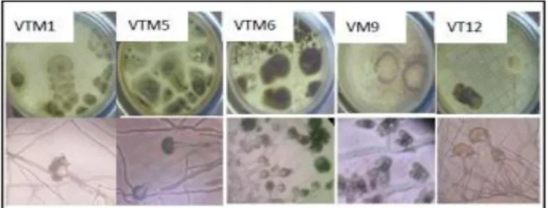 Gambar 4.1. Mikroskopi isolat VTM1, VTM5, VTM6, VTM9 dan VT 12  g.  Angka  