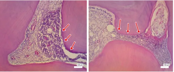 Gambar 5. Gambaran mikroskopis pulpa pada hari ke-5 setelah aplikasi asam fosfat 37%. (A) Tampak lapisan  odontoblas mengalami kerusakan dan kehilangan kontinuitasnya