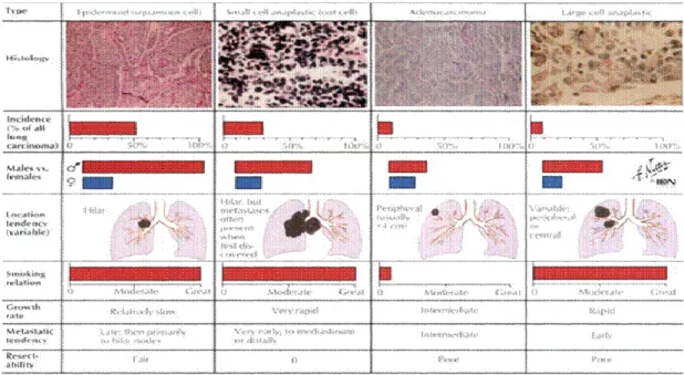 Gambar 2.1. Klasifikasi kanker paru berdasarkan morfologi jaringannya  (Harrison,2012) 