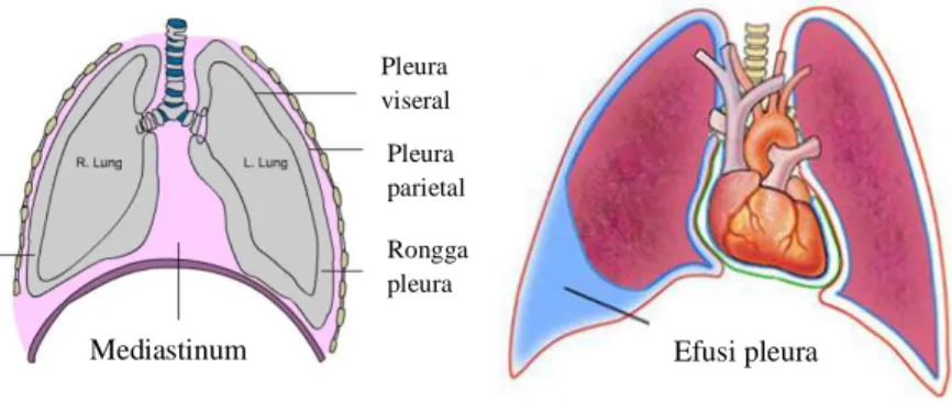 Gambar 2 Anatomi pleura paru. (a) pleura normal; (b) efusi pleura 