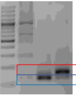 Gambar  11  Hasil  analisis  mutasi  gen  KRAS  menggunakan  metode  RFLP.  (a)  kodon 12; (b) kodon 13  M   A549  BT   HCT  M   A549   BT   HCT 1000 pb 500 pb 200 pb  100 pb 3000 pb 1000 pb 500 pb 200 pb  100 pb Mutan  Wild type  Mutan   Wild type 