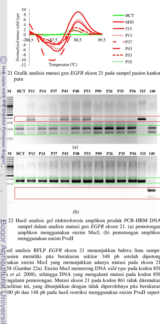 Gambar 21 Grafik analisis mutasi gen EGFR ekson 21 pada sampel pasien kanker  paru 
