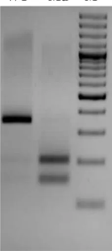 Gambar  15  Hasil  analisis  mutasi  gen  EGFR  menggunakan  metode  RFLP.  (a)  ekson 19, (b) ekson 21 kodon 858 dan (c) ekson 21 kodon 861