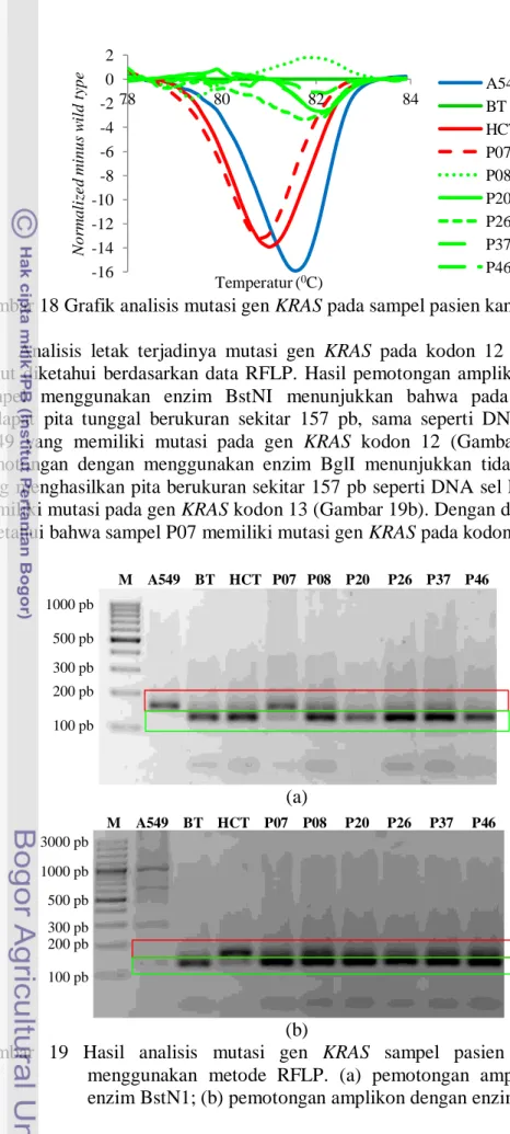 Gambar 18 Grafik analisis mutasi gen KRAS pada sampel pasien kanker paru          