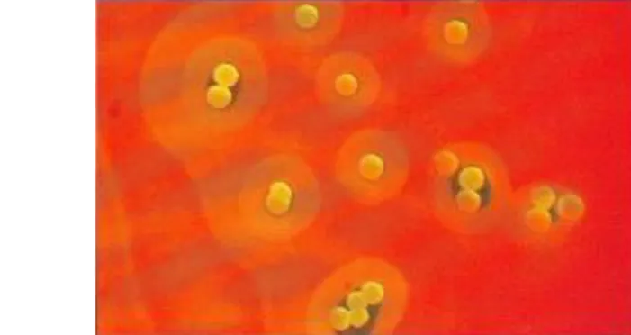 Gambar 6 Hemolisis pada agar darah oleh S. aureus (Quinn et al. 2004). 