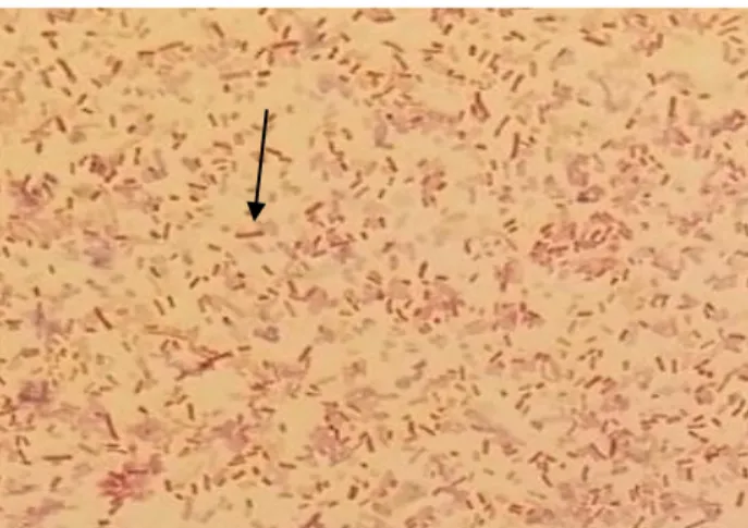 Gambar  3.  Bakteri  Salmonella  sp  hasil  pewarnaan  Gram  diamati  dengan  mikroskop pembesaran 1000 kali