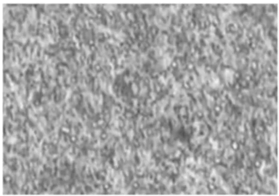 Gambar 1 Struktur Mikro Baja Amutit Sebelum  Dikeraskan:Pearlite lamelar (hitam) dan sebagian 