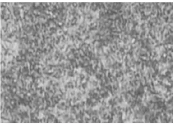 Gambar 3 Struktur Mikro Baja Amutit Diquenching  Dengan Dromus 1:10Tempering Suhu 400 o  C