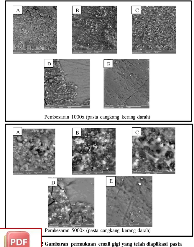 Gambar  5.2 Gambaran  permukaan  email gigi yang telah diaplikasi  pasta  cangkang  kerang darah  dengan  5 sampel yang berbeda  (A,B,C,D,E) 