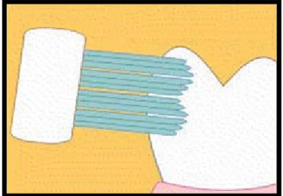 Gambar 5:  Bulu sikat gigi power driven diletakkan                        menghadap ke  permukaan gigi