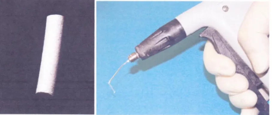Gambar  2A  Resin-percha  pellet,  B  Resin-percha  termoplastis  menggunakan  Obtura  gun  (Sumber:  Resilon  obturation material-the new standard of care? [serial online]