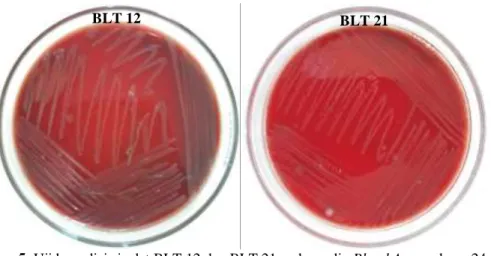 Gambar 5. Uji hemolisis isolat BLT 12 dan BLT 21 pada media Blood Agar selama 24 jam. 