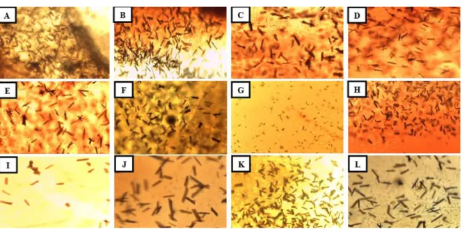 Tabel 4  Pengaruh  paparan  sabun  mandi  cair  non  antiseptik  pada  bercak  darah  terhadap  kristal hemoglobin dengan tes Takayama 