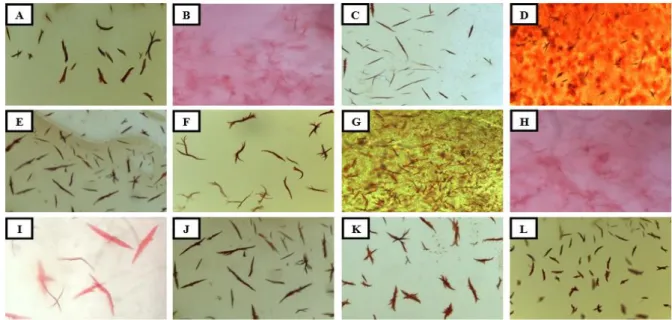 Gambar 3  Kristal hemoglobin pada preparat bercak darah dengan tes Takayama  setelah dipapar sabun A, B, C, D, E, F, G, H, I, J, K, L dengan perbesaran 40x10 
