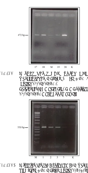 Tabel 2.  Persentase delesi gen RBM dan DAZ, delesi RBM  dan atau DAZ