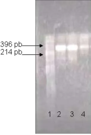 Gambar 2: Hasil PCR DNA pengkode S 80-