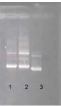 Gambar  3  :  Kurva  hubungan  antara  jarak  migrasi  dengan  logaritma  ukuran  marker  DNA pUC/HinfI 