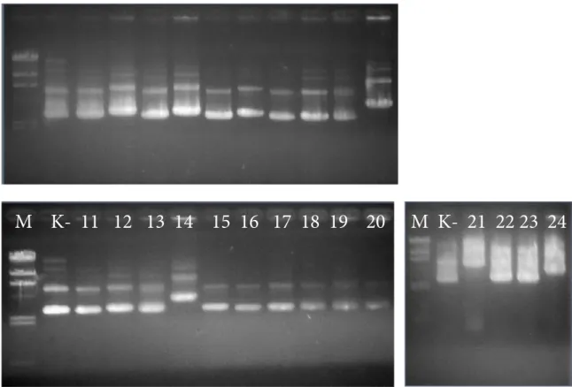 Gambar 1. Elektroforesis hasil isolasi plasmid rekombinan. M. Marka DNA λ HindIII; K-