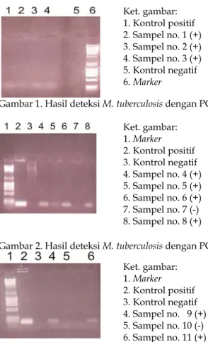 Gambar 3. Hasil deteksi M. tuberculosis dengan PCRKet. gambar:  1. Marker 2. Kontrol positif   3