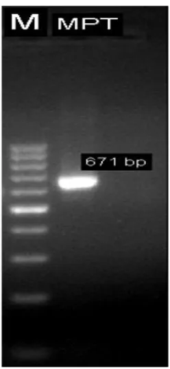 Gambar 1. DNA Hasil Purifikasi Ket. : M= Marker 100 bp, MPT= Mycobacterium  Protein Tuberkulosis 671 bp 