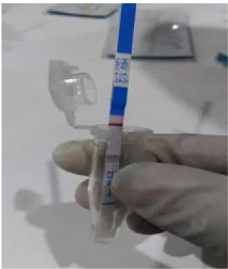 Gambar 1 Pengujian Serum pada Sampel Terhadap HIV dengan rapid test