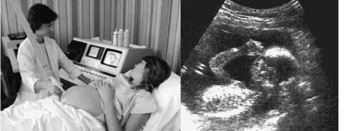 Gambar dari janin dalam kandungan dapat juga dihasilkan dengan menggunakan sinar-X. Tetapi, ibu  hamil disarankan untuk menghindari penyinaran sinar-X pada kandungannya