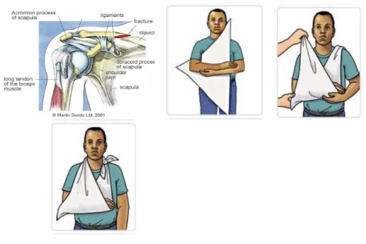 Gambar 3: Cara pemakaian sling/mitela 