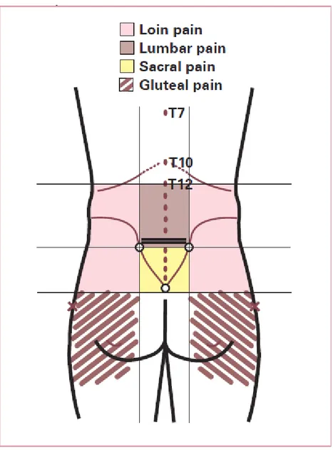Gambar 8. Lokasi Rasa Sakit. 1 Dikutip dari : Jensen S. Back pain-clinical assessment