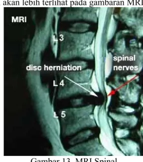 Gambar 13. MRI Spinal